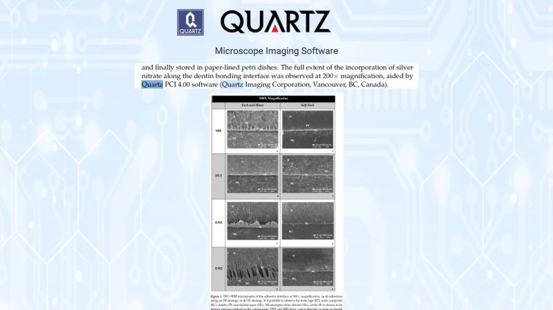 SEM image of silver nitrate nanoleakage at a dental adhesive dentin interface, analyzed with Quartz PCI
