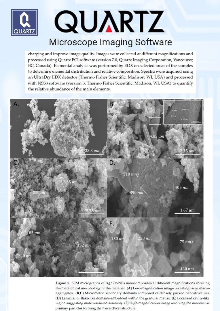 SEM micrograph of Ag/Zn nanocomposites from Chlorella vulgaris extract, processed with Quartz PCI