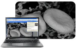 A laptop running Quartz PCI-CFR with an SEM image of blood cells in the background